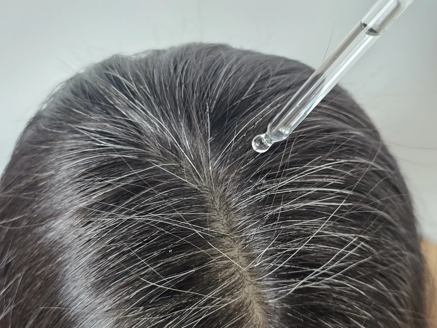 Crowned dropper applying serum along a part line