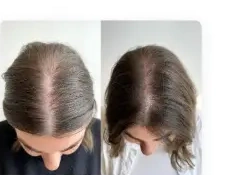 Vorher-Nachher-Foto der Haare aus der Bewertung von Emily S.