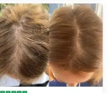 Vorher-Nachher-Foto der Haare aus der Bewertung von Rachel B.